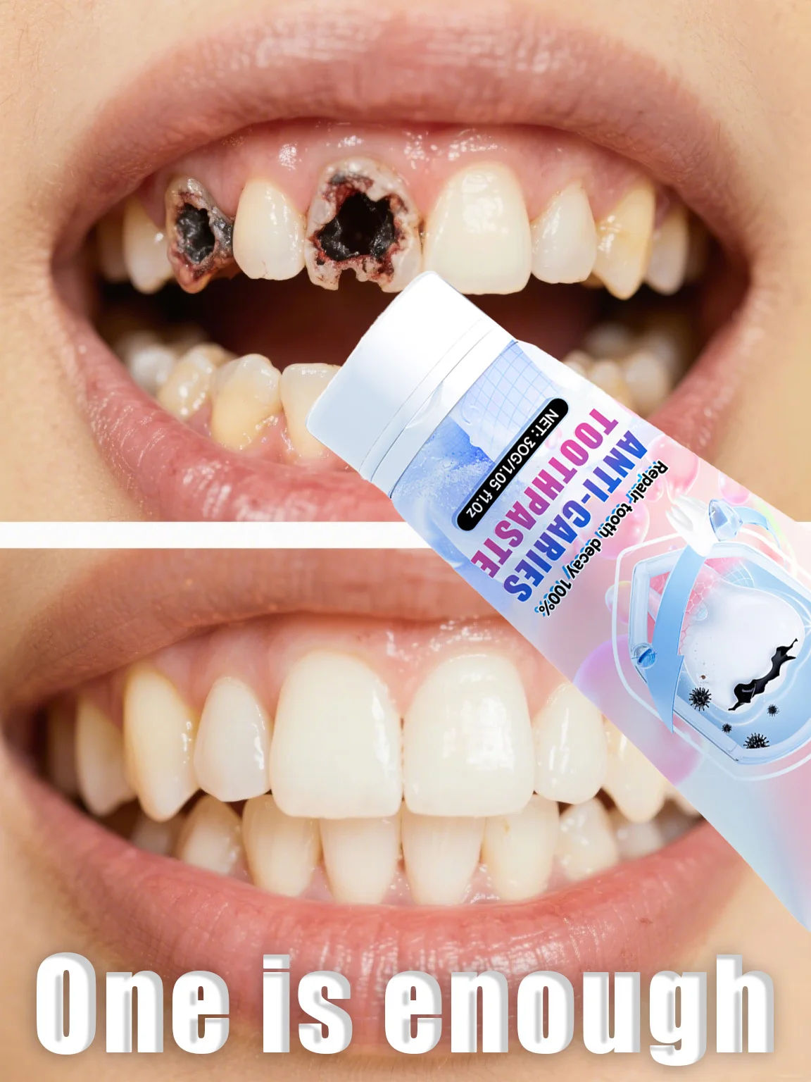 Teeth Whitening Charcoal Powder - ⁹⁹% ᵒᶠ ᵖᵉᵒᵖˡᵉ ʳᵉᵖᵘʳᶜʰᵃˢᵉ ᵗᵒ ʳᵉপَاⁱʳ