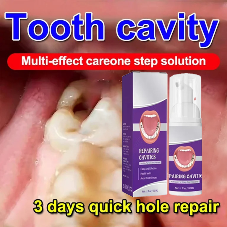 Teeth Whitening Treatment - Pasta Gigi Pembersih Gigi Menghilangkan Noda