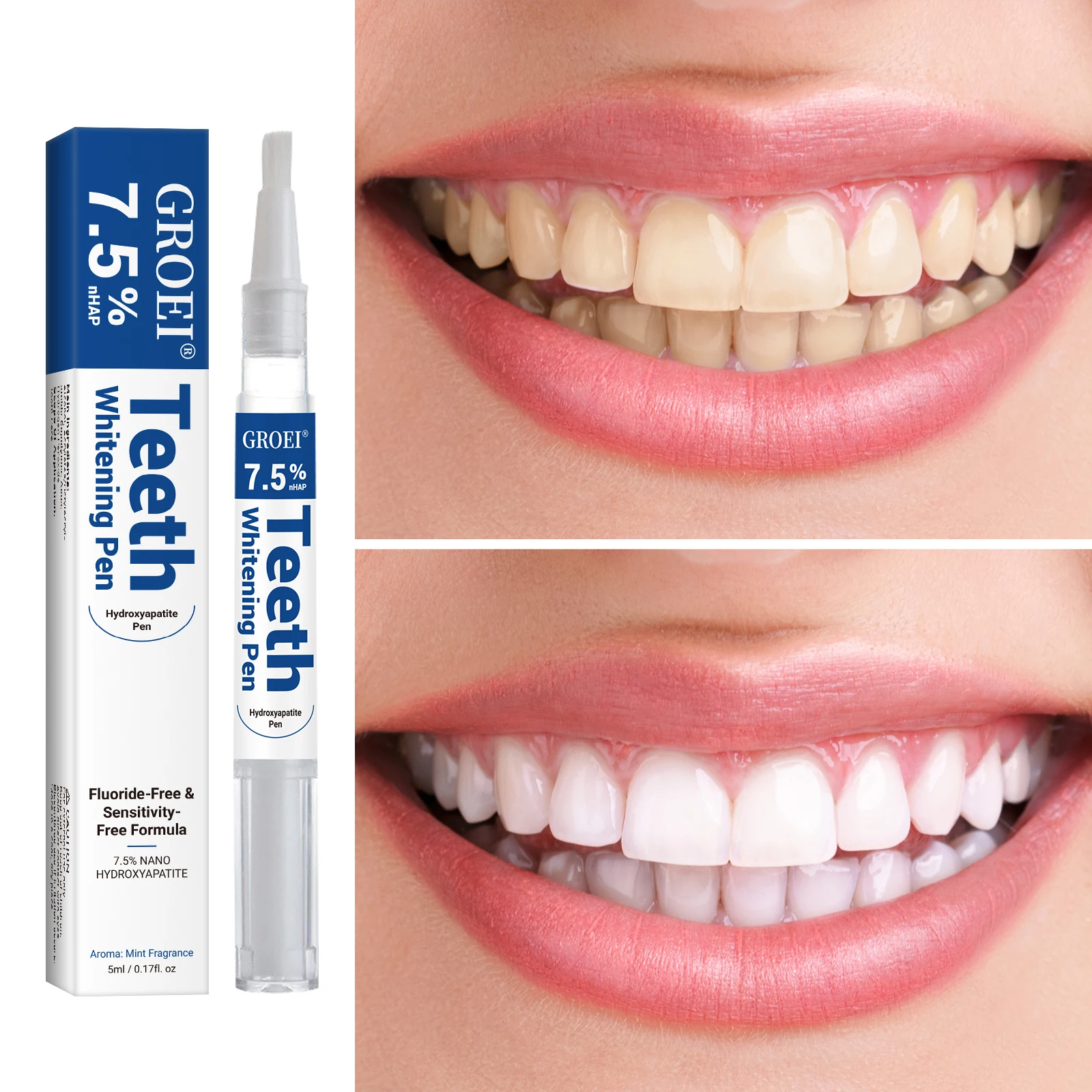 Pena Pemutih Gigi Hidroksiapat - Teeth Whitening Gels ulasan dan harga