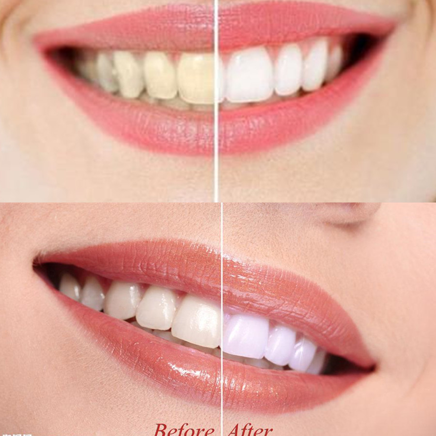 Arang Bambu Gigi Gigi Gigi Gig - Teeth Whitening Charcoal Powder ulasan dan harga