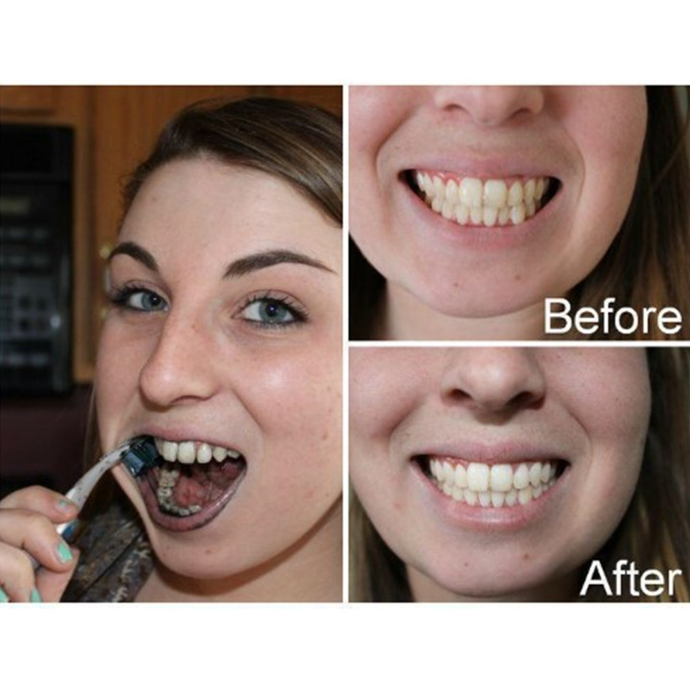 Arang Bambu Gigi Gigi Gigi Gig - Teeth Whitening Charcoal Powder ulasan dan harga