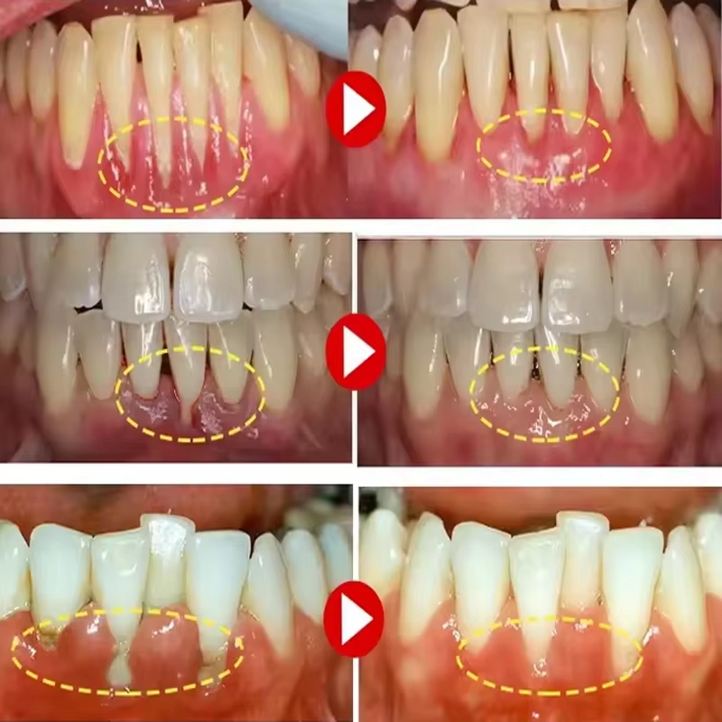 Gel Pemutih Gigi Perawatan Per - Teeth Whitening Gels ulasan dan harga