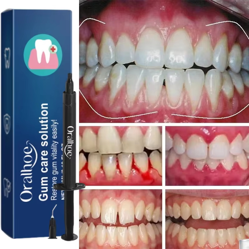 Gel Pemutih Gigi Perawatan Per - Teeth Whitening Gels ulasan dan harga