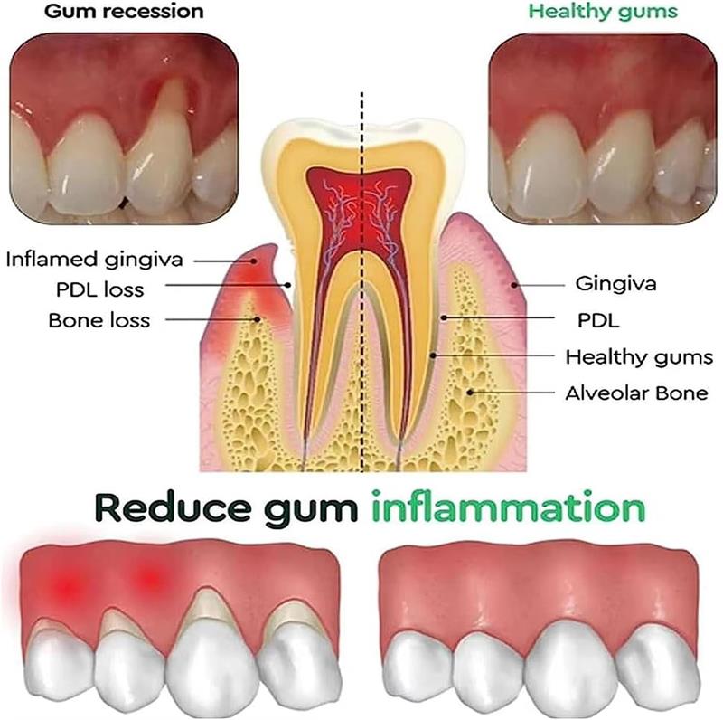Gel Pemutih Gigi Perawatan Per - Teeth Whitening Gels ulasan dan harga