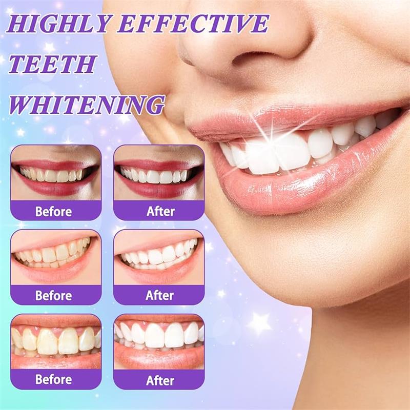 Pasta Gigi Pemutih Gigi Ungu 9 - Teeth Whitening Treatment ulasan dan harga