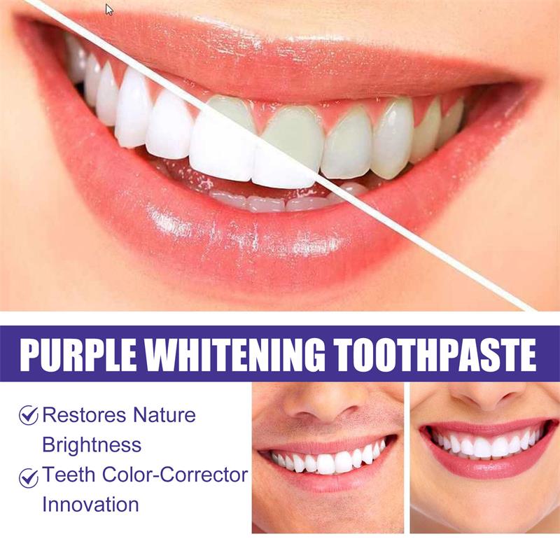 Pasta Gigi Pemutih Gigi Ungu 9 - Teeth Whitening Treatment ulasan dan harga