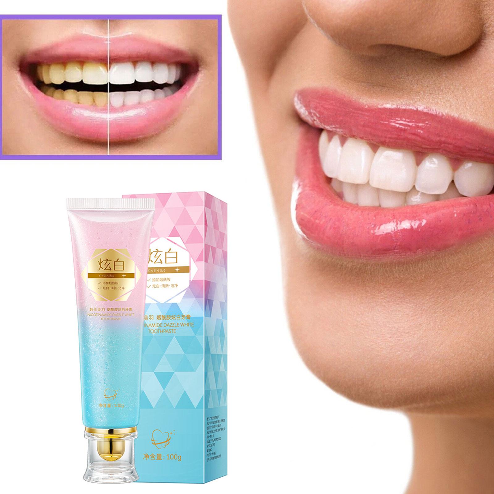 Pasta Gigi Pemutih Niacinamide - Teeth Whitening Treatment ulasan dan harga