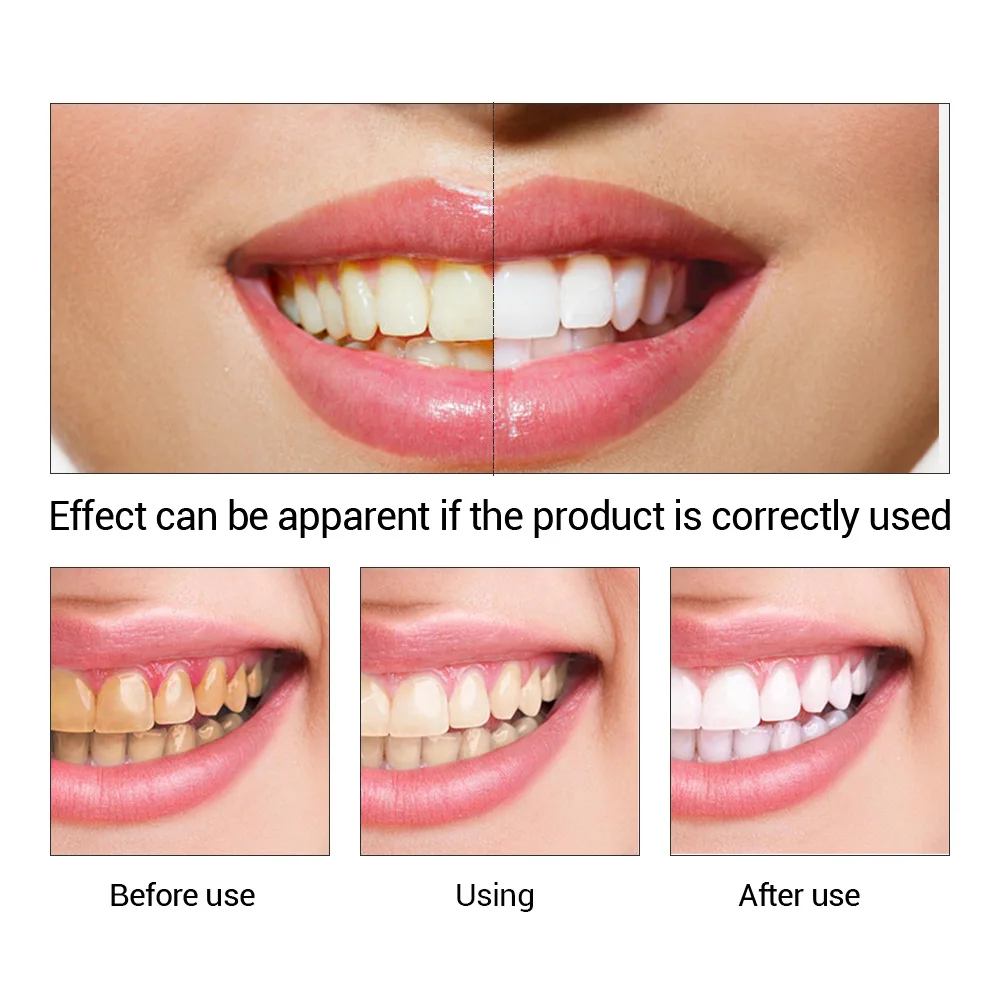 FTEENPLY Bubuk Esensi Pemutih  - Teeth Whitening (Bleaching) ulasan dan harga