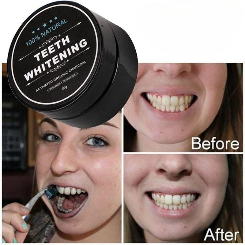1 Kotak Bubuk Pemutih Gigi Ara - Teeth Whitening Charcoal Powder ulasan dan harga