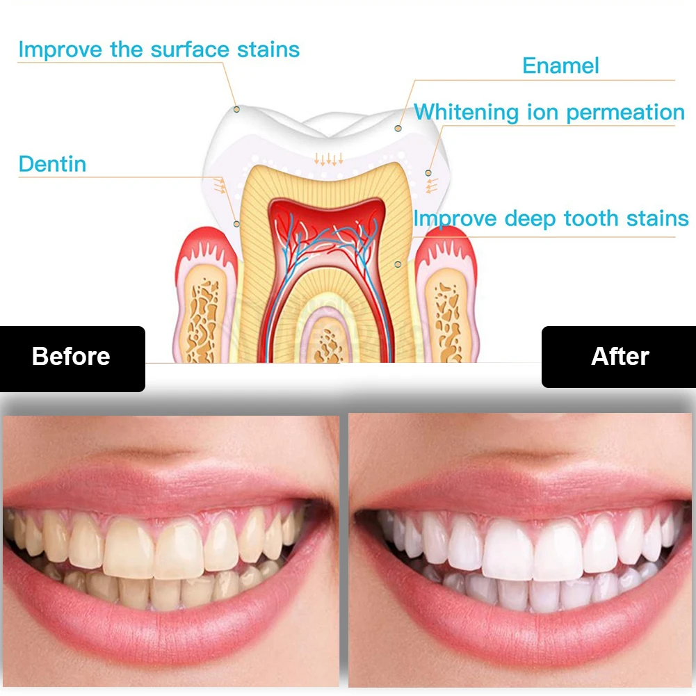 Kit pemutih gigi Mini 16 LED c - Teeth Whitening Gels ulasan dan harga