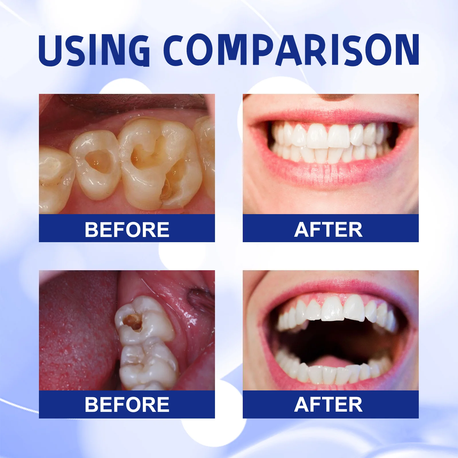 ⁹⁹% ᵒᶠ ᵖᵉᵒᵖˡᵉ ʳᵉᵖᵘʳᶜʰᵃˢᵉ ᵗᵒ ʳᵉ - Teeth Whitening Charcoal Powder ulasan dan harga