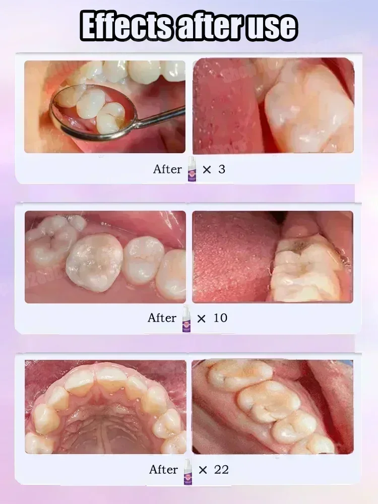 Pasta Gigi Pembersih Gigi Meng - Teeth Whitening Treatment ulasan dan harga