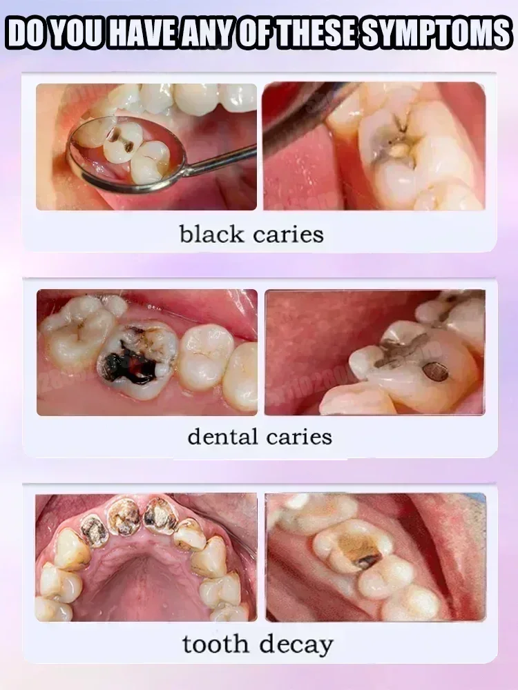 Pasta Gigi Pembersih Gigi Meng - Teeth Whitening Treatment ulasan dan harga
